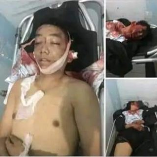 Pelaku Begal Di Perbaungan Tewas Dilindas Truk Saat Menjalankan Aksinya