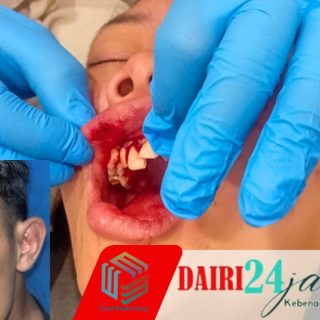 Dugaan Kejanggalan di Balik Kasus Pengeroyokan Simpang Pujes Sidikalang: Dua Terduga Pelaku Dilepaskan